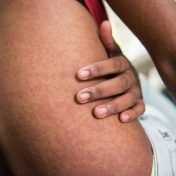 antiinflamatorios
