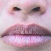 labios agrietados