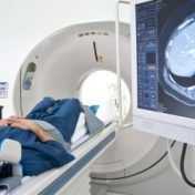 radioterapia