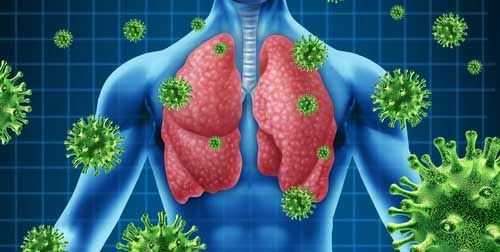 Infeccion respiratoria aguda por coronavirus