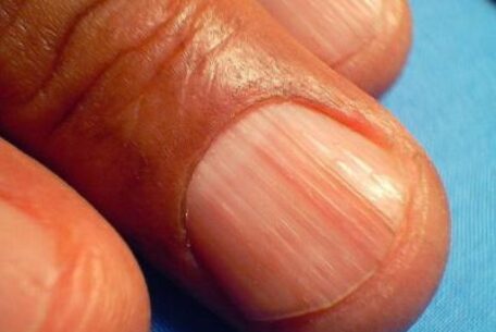 Hidrata tus uñas con estos remedios caseros 1 Hidrata tus uñas con estos remedios caseros