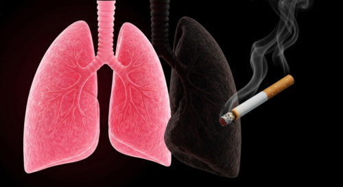 Photorealistic image of a pair of human lungs, one pink and healthy on the left, and one dark, damaged and shrunken on the right, with a cigarette burning near the damaged lung. Dark background, drama