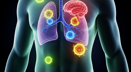 Photorealistic image of a human torso with glowing immune cells (T-cells) attacking tumor cells in the lungs and brain, symbolic representation of immunotherapy, medical illustration style, bright col